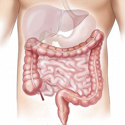 Irritable Bowel Syndrome treatment in Pune